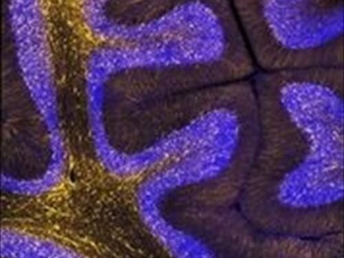 Los genes humanos que más rápido evolucionan están vinculados al desarrollo del cerebro