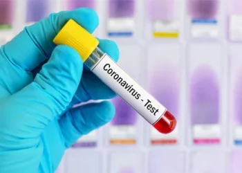 EEUU exige a viajeros prueba de Covid-19 de 24 horas de anticipación