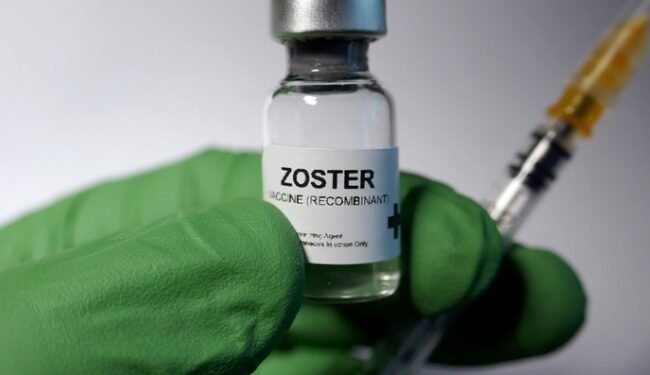 El herpes zóster puede reactivarse luego de la vacunación contra el COVID-19