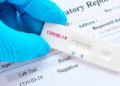 Pruebas Covid en casa no tienen validez según autoridades de salud