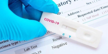 Pruebas Covid en casa no tienen validez según autoridades de salud