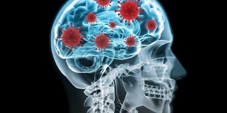 Descubren la posible causa de la ‘niebla mental’, una de las secuelas del covid-19 que afecta a la memoria y la atención