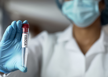 Descubren que el virus del ébola puede sobrevivir al tratamiento y ocultarse en el cerebro durante años antes de reinfectar a su huésped