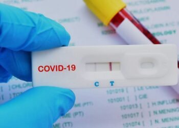 Pocas ventas de pruebas antígenos en las farmacias