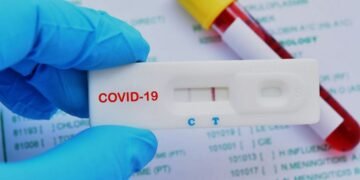 Pocas ventas de pruebas antígenos en las farmacias