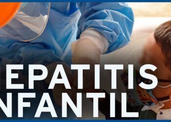 La OMS advierte de la detección de 650 casos potenciales de hepatitis infantil de origen desconocido en el mundo