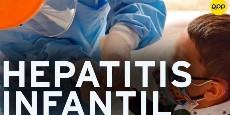 La OMS advierte de la detección de 650 casos potenciales de hepatitis infantil de origen desconocido en el mundo
