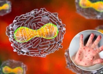 La viruela del mono es “poco probable” que se convierta en una pandemia, según OMS