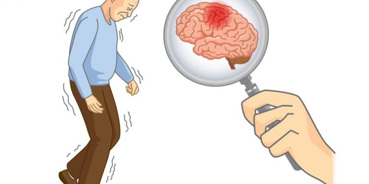 Un estudio revela que las pesadillas frecuentes en hombres podrían ser una señal temprana del párkinson