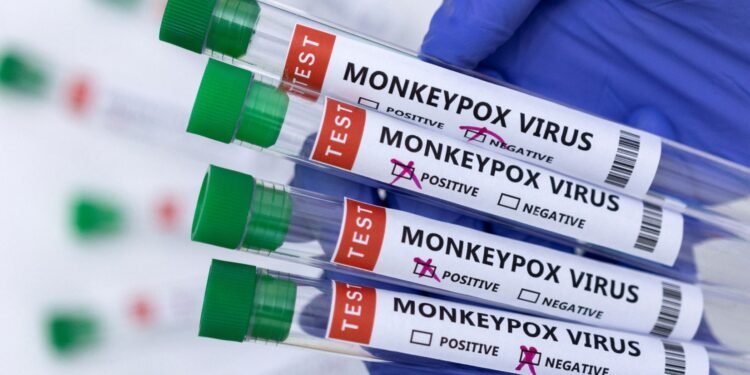 Expertos advierten que se acaba el tiempo para detener la propagación de la viruela del mono