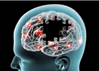 Se incrementa el Alzheimer dice Puello Herrera