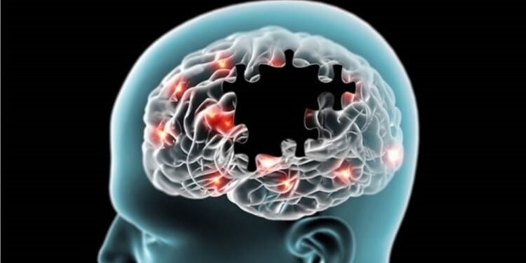 Se incrementa el Alzheimer dice Puello Herrera