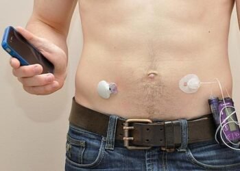 Prueban con éxito páncreas artificial paciente diabetes