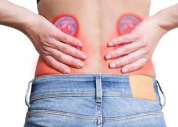 Cálculos renales, ¿por qué aparecen y cómo evitarlos?