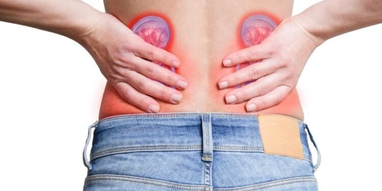 Cálculos renales, ¿por qué aparecen y cómo evitarlos?