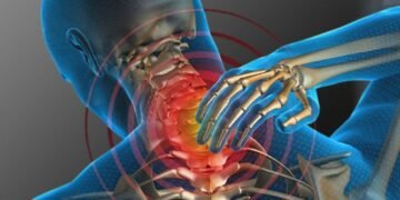 Tratar la esclerosis múltiple en los primeros seis meses reduce el riesgo de discapacidad