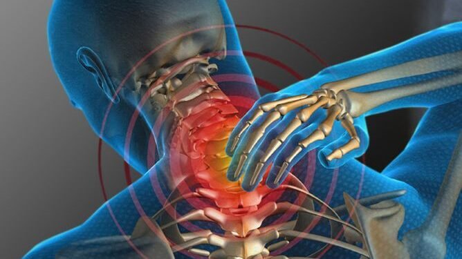 Tratar la esclerosis múltiple en los primeros seis meses reduce el riesgo de discapacidad