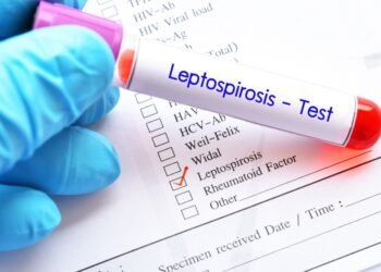 La leptospirosis ha causado 23 muertes