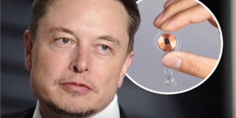 Empresa de Elon Musk recluta voluntarios para su primer ensayo de implante cerebral en humanos