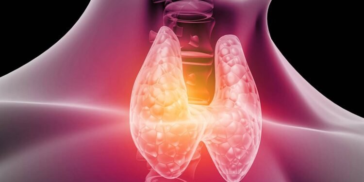 Advierten aumento de pacientes con cáncer de tiroides
