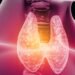 Advierten aumento de pacientes con cáncer de tiroides