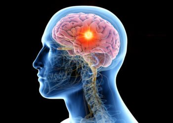 Experto advierte sobre el desafío del incremento de las metástasis cerebrales