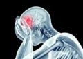 Neurólogo alerta dolor de cabeza puede ser antesala de males peores