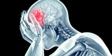 Neurólogo alerta dolor de cabeza puede ser antesala de males peores