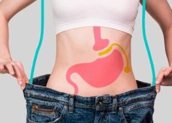 Cirugías bariátricas: ¿cuántas se realizan en RD y cuáles son sus costos?