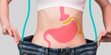 Cirugías bariátricas: ¿cuántas se realizan en RD y cuáles son sus costos?