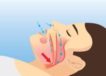 Plutarco Arias: El 10 % de los dominicanos de más de 40 años tiene apnea del sueño