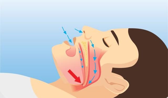Plutarco Arias: El 10 % de los dominicanos de más de 40 años tiene apnea del sueño