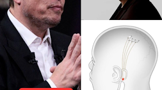 El primer paciente humano al que se le implantó un chip cerebral de Neuralink,es capaz de controlar un mouse de computadora usando sus pensamientos.
