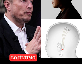 El primer paciente humano al que se le implantó un chip cerebral de Neuralink,es capaz de controlar un mouse de computadora usando sus pensamientos.