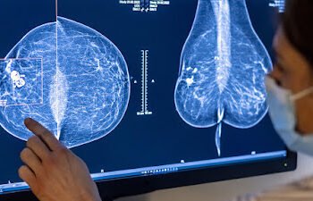 Los sujetadores del futuro detectarán el cáncer de mama