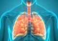 El 11% de las personas que padece de tuberculosis en RD mueren; reducir tasa de legalidad sigue siendo un reto