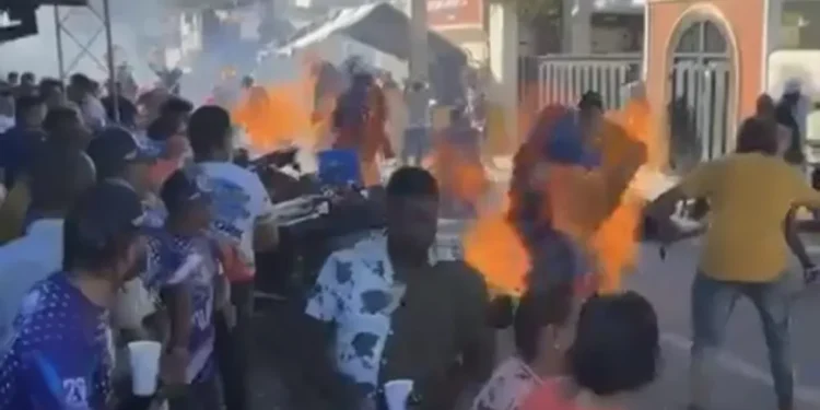Se elevan a 18 los quemados en Carnaval de Salcedo; entre víctimas hay 10 menores