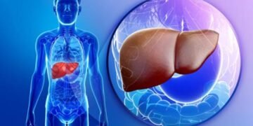 La FDA aprobó el primer medicamento para una enfermedad hepática común y grave
