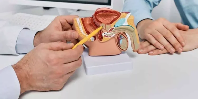 Los casos de cáncer de próstata se duplicarán en 2040 y las muertes crecerán el 85 %