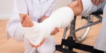 Cuáles son las fracturas más frecuentes en pacientes accidentados