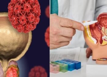 Cáncer de próstata: letalidad, prevención y tratamiento