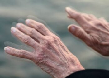 “No podemos normalizar los temblores”, alerta neurocirujana sobre la enfermedad de Parkinson