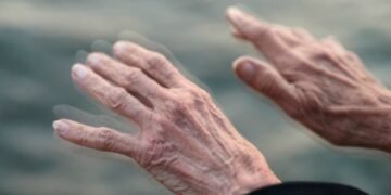 “No podemos normalizar los temblores”, alerta neurocirujana sobre la enfermedad de Parkinson