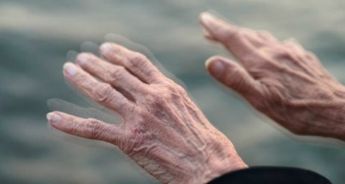 “No podemos normalizar los temblores”, alerta neurocirujana sobre la enfermedad de Parkinson