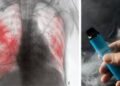 Sociedades médicas dudan sobre impacto de impuestos a bebidas y cigarrillos