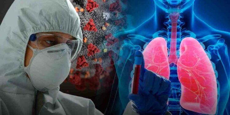 La tuberculosis supera al covid-19 y vuelve a ser la enfermedad infecciosa más mortal