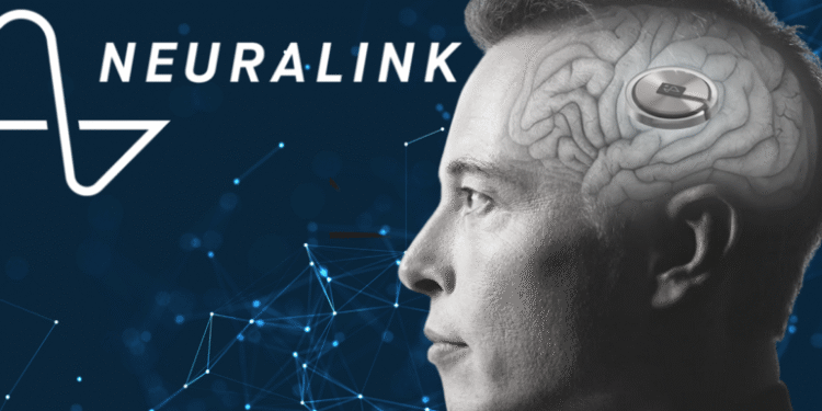 Neuralink, de Elon Musk, promete llevar al ser humano a un nuevo nivel cognitivo