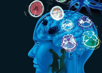 Señales tempranas de esclerosis múltiple, según estudio de universidad canadiense