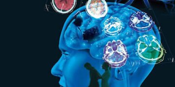 Señales tempranas de esclerosis múltiple, según estudio de universidad canadiense