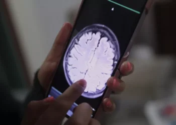 La IA detecta cáncer de mama 5 años antes de los síntomas, afirma José Joaquín Puello